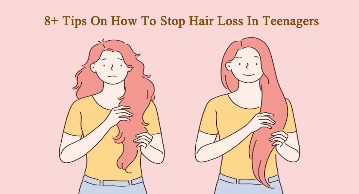 hair loss in teenager- 8+ Tips On How To Stop Hair Loss In Teenagers