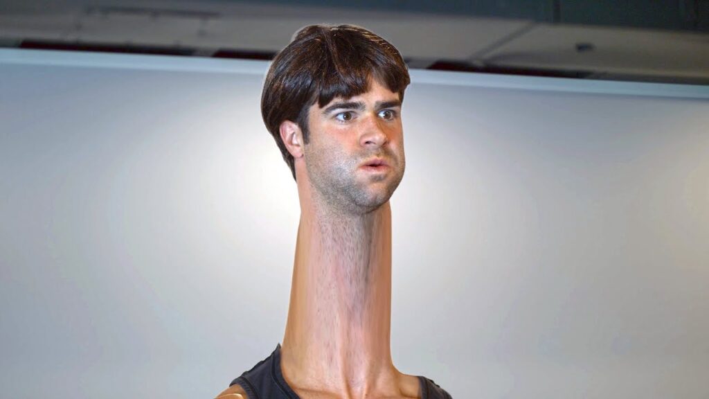 Who Has The Longest Neck In The World? And How Do You Compare?